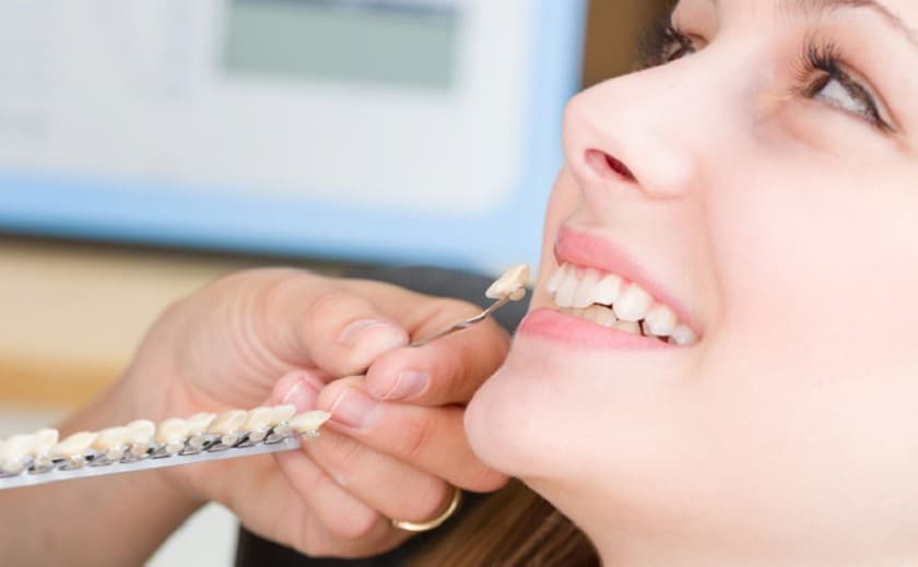 Cách có răng khểnh thẩm mỹ, tự nhiên và an toàn