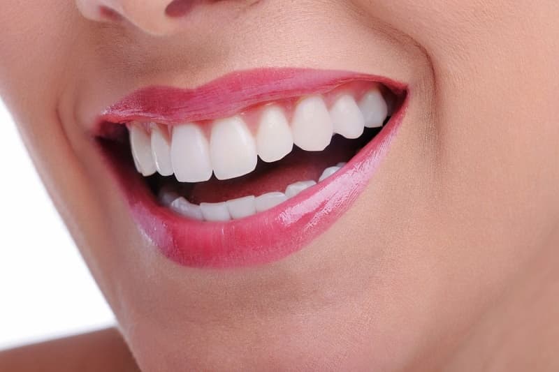 5 BƯỚC TRONG QUY TRÌNH TRỒNG RĂNG IMPLANT