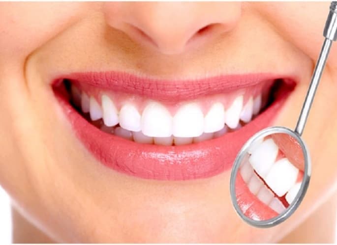 Răng sứ thẩm mỹ