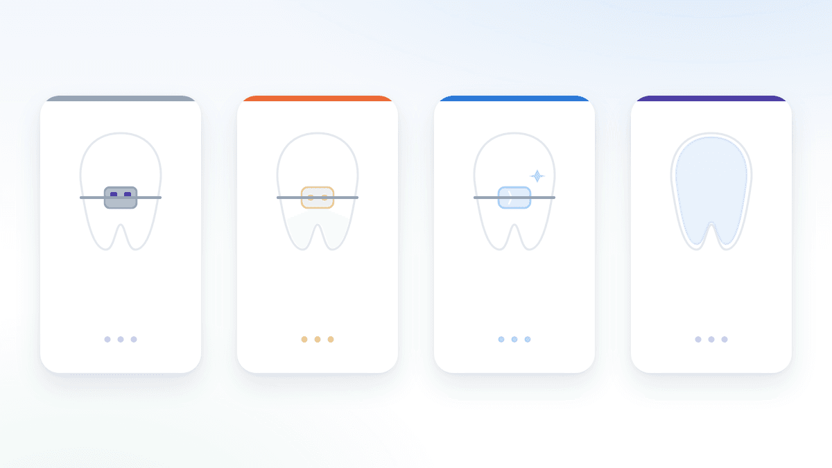 Bốn loại niềng răng phổ biến: mắc cài kim loại, sứ, pha lê và khay trong suốt Invisalign