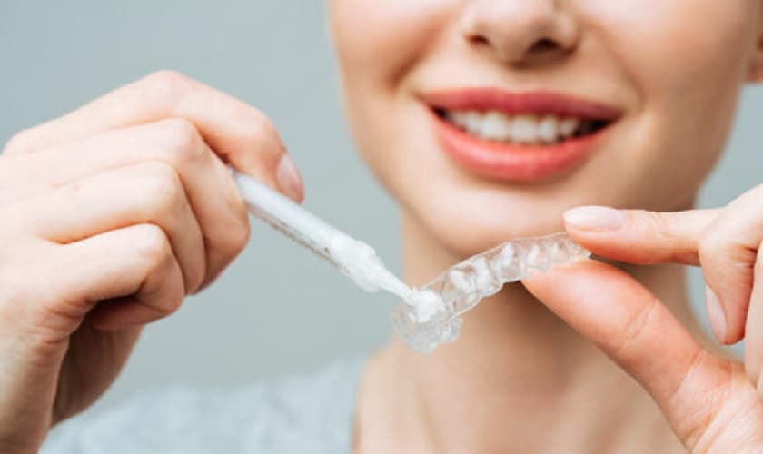 Những điều cần biết về gel trắng răng tại nhà