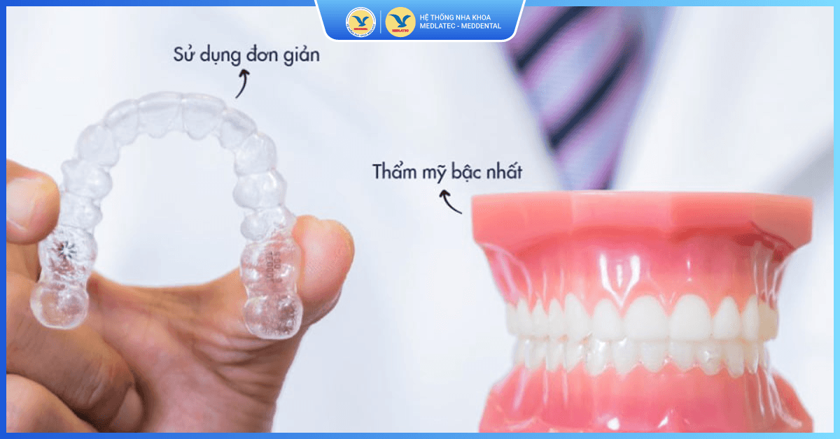 Niềng răng trong suốt Invisalign