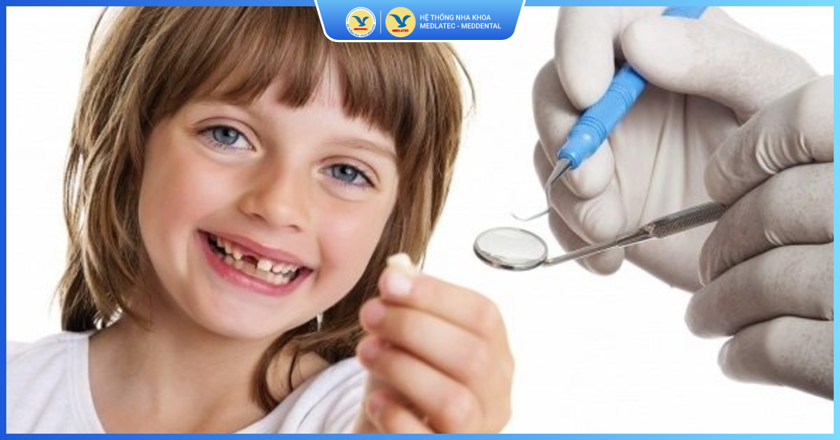 Chăm sóc sau khi nhổ răng sữa cho bé thế nào? - Nhổ răng sữa cho trẻ em