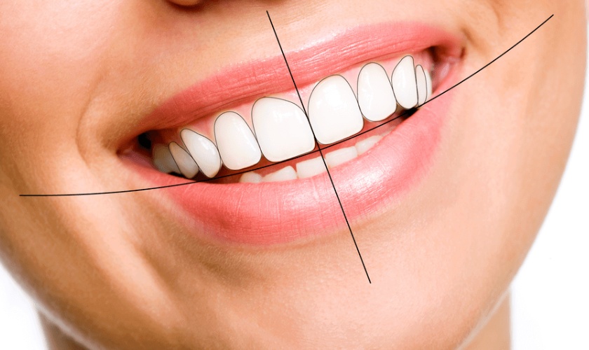 Khớp cắn chuẩn mang lại rất nhiều lợi ích