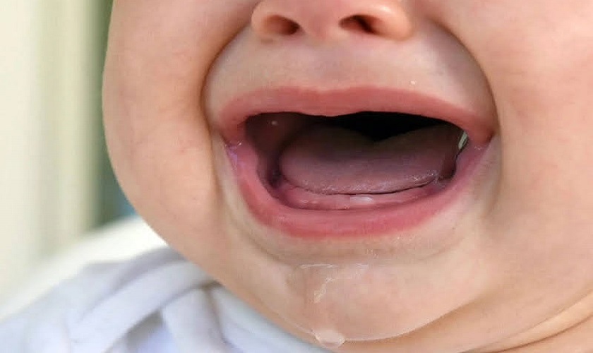 Một số biểu hiện sốt mọc răng ở trẻ nhỏ Một số biểu hiện sốt mọc răng ở trẻ nhỏ