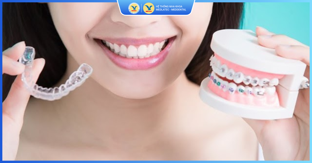 Những ai phù hợp niềng răng trong suốt Invisalign? - Niềng răng trong suốt Invisalign