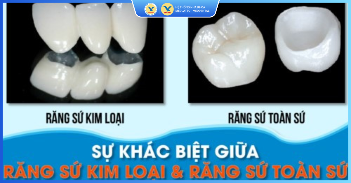 Bọc răng sứ nguyên hàm nên chọn loại nào? - Răng sứ toàn hàm