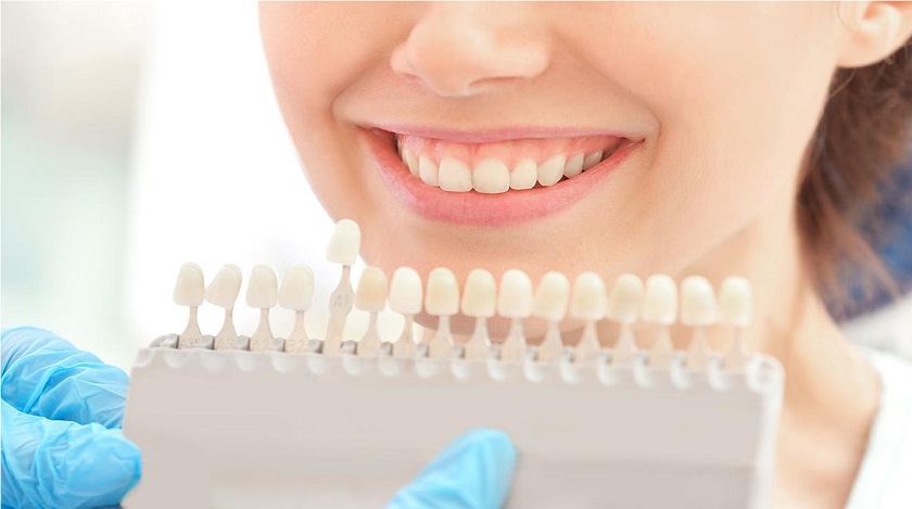 Cách kiểm tra độ sáng răng Cách kiểm tra độ sáng răng