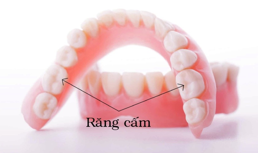 Răng cấm giữ vai trò ăn nhai chính trên cung hàm Răng cấm giữ vai trò ăn nhai chính trên cung hàm