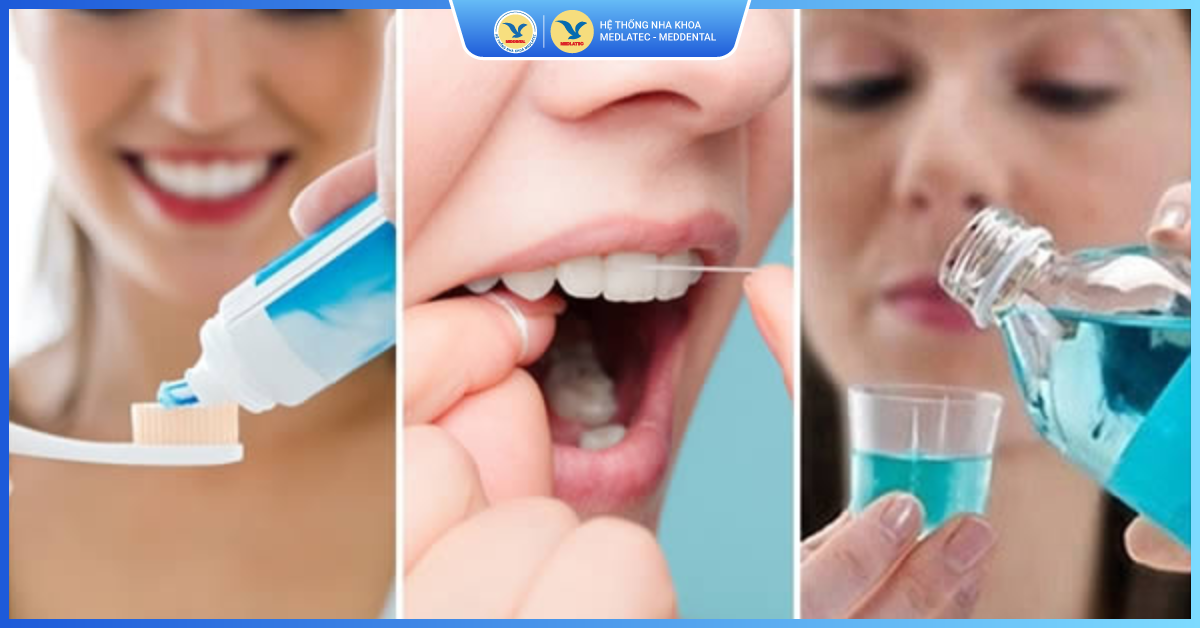 Lưu ý sau khi trám răng khểnh - Trám răng khểnh