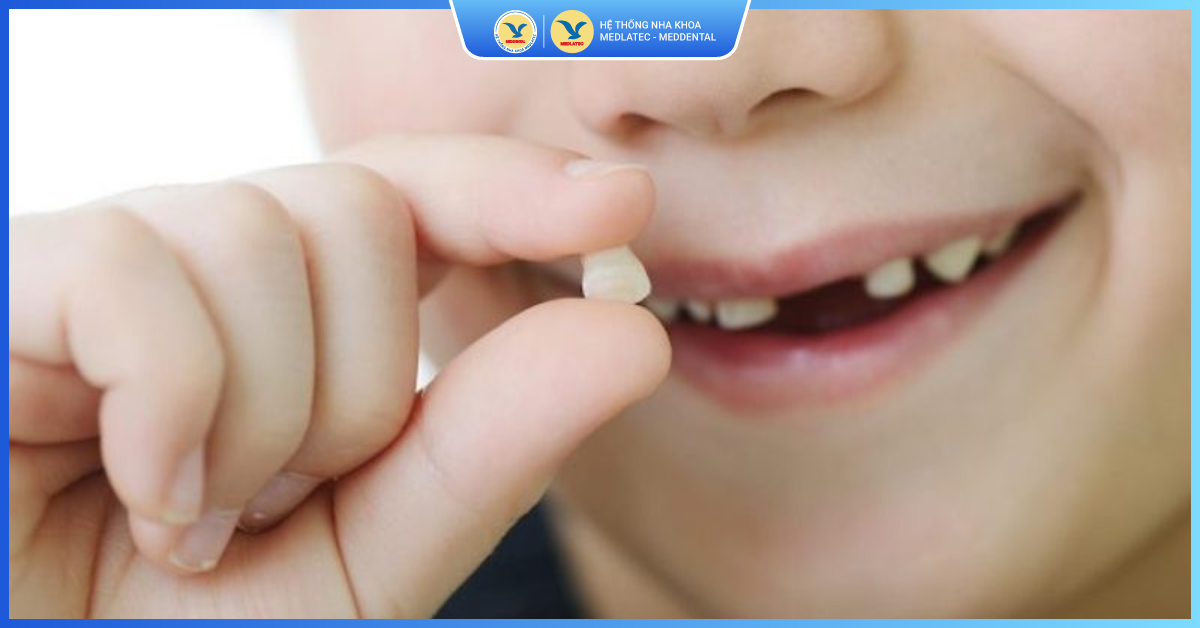 Nguyên nhân khiến trẻ bị sốt sau khi nhổ răng - Nhổ răng sữa cho trẻ em