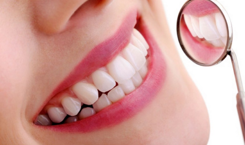 Bọc răng sứ mang lại thẩm mỹ cao