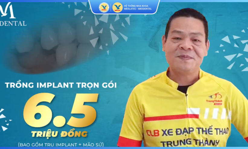 Phản hồi của khách hàng Nguyễn Vi Thắng về dịch vụ Trồng răng Implant tại MedDental