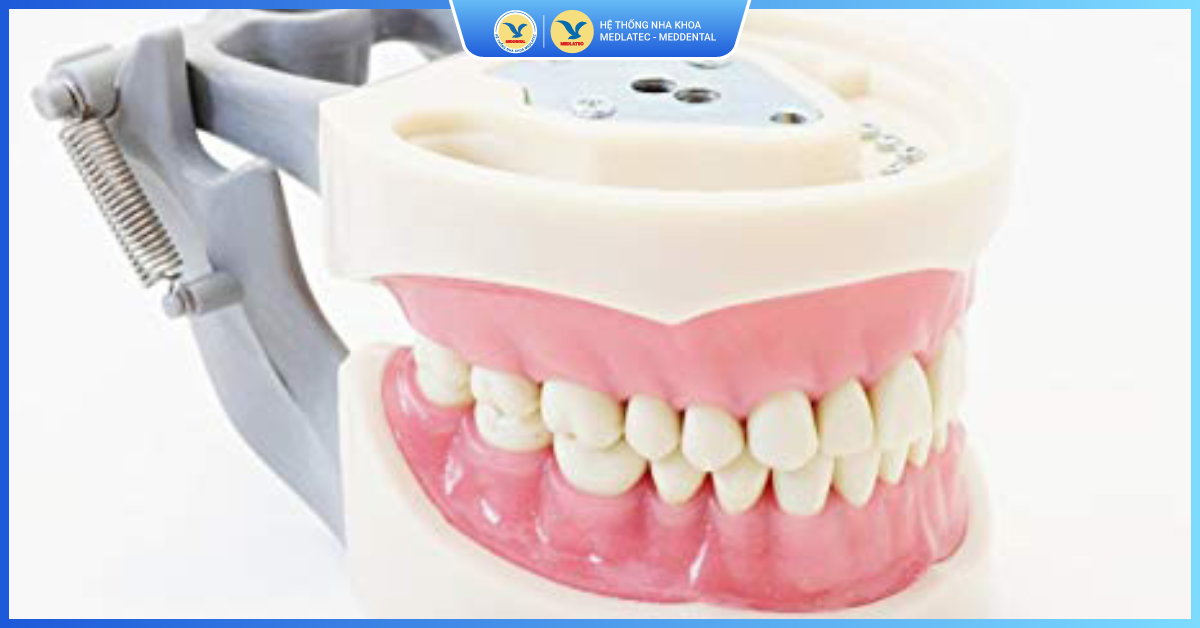 Làm răng tháo lắp nguyên hàm - Trồng răng nguyên hàm