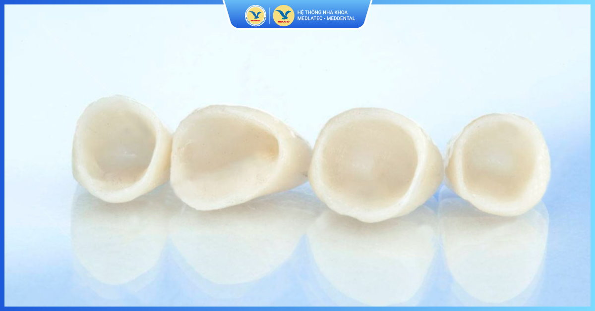 Ưu điểm vượt trội của răng sứ thẩm mỹ toàn sứ - Răng toàn sứ