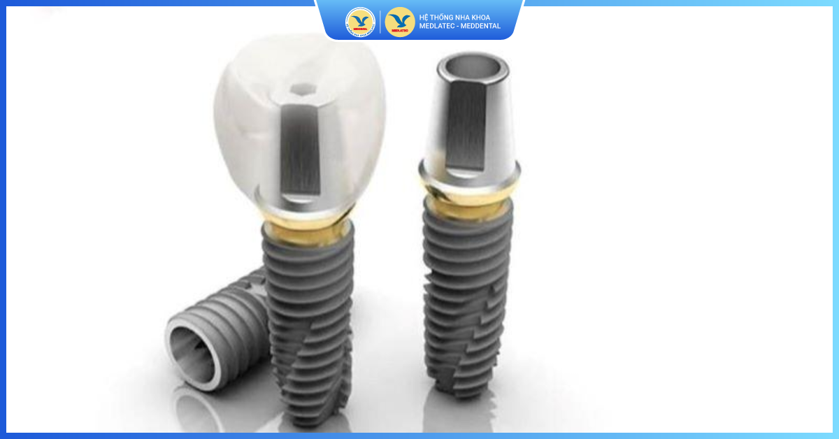Trụ Implant Hàn Quốc Dentinum - Trồng răng Implant