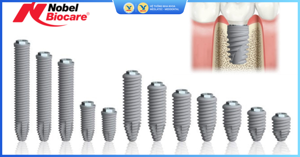 Trụ Implant Mỹ Nobel Biocare - Trồng răng Implant