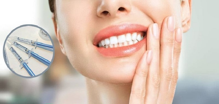 Các loại gel trắng răng kém chất lượng có thể gây ra tác động tiêu cực đến sức khỏe