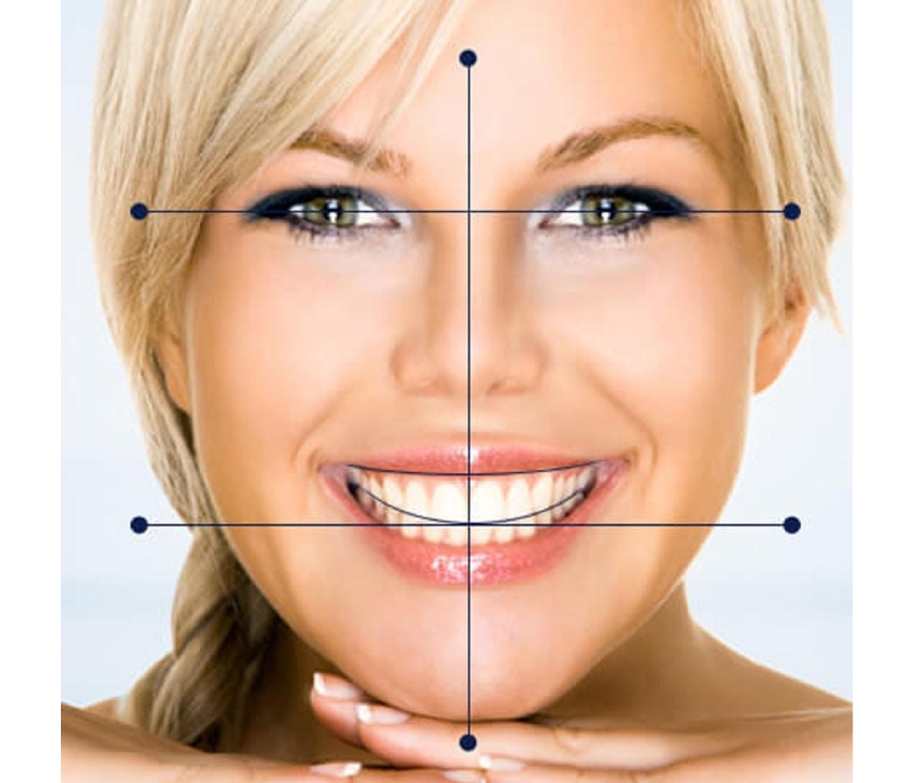 Trục đối xứng chuẩn